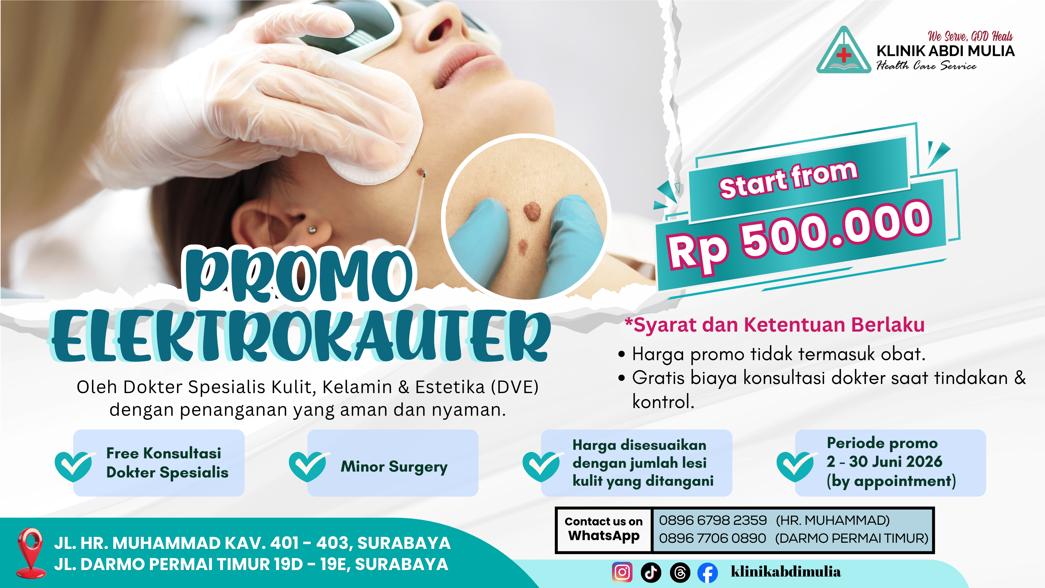 LCD - Promo Elektrokauter Juni 2026
